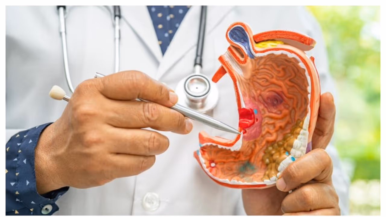 Weight Loss, Bloating, Indigestion: Could These Digestive Symptoms Point to Cancer? Weight Loss, Bloating, Indigestion: Could These Digestive Symptoms Point to Cancer?
