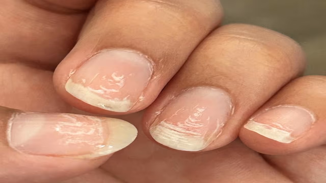 Health Tips Health Tips