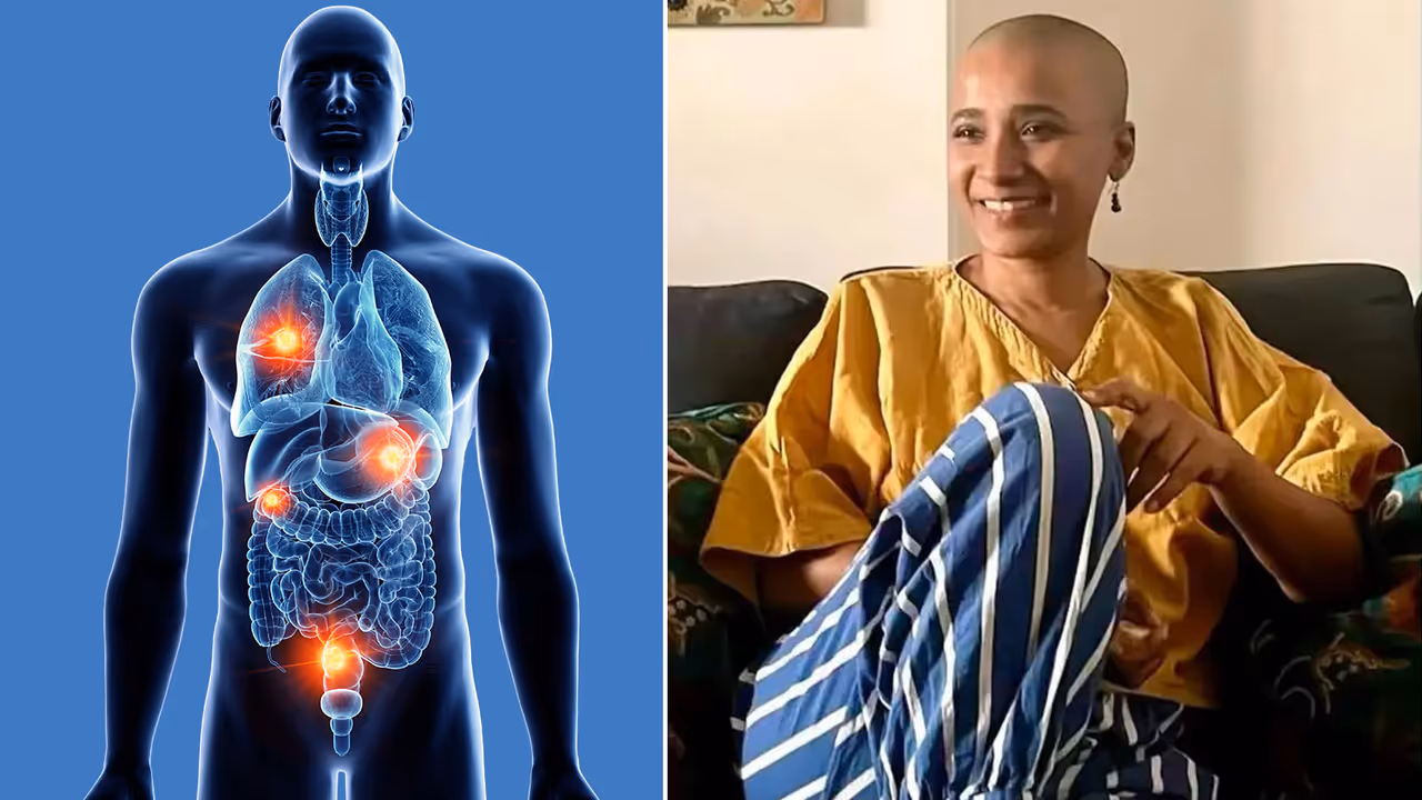 ओलिगोमेटास्टैटिक कैंसर के लक्षण और कारण