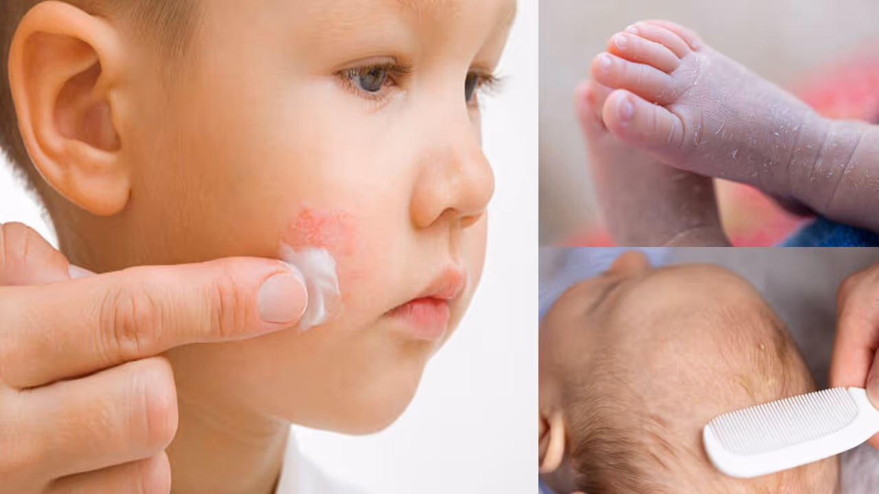 winter baby skin care