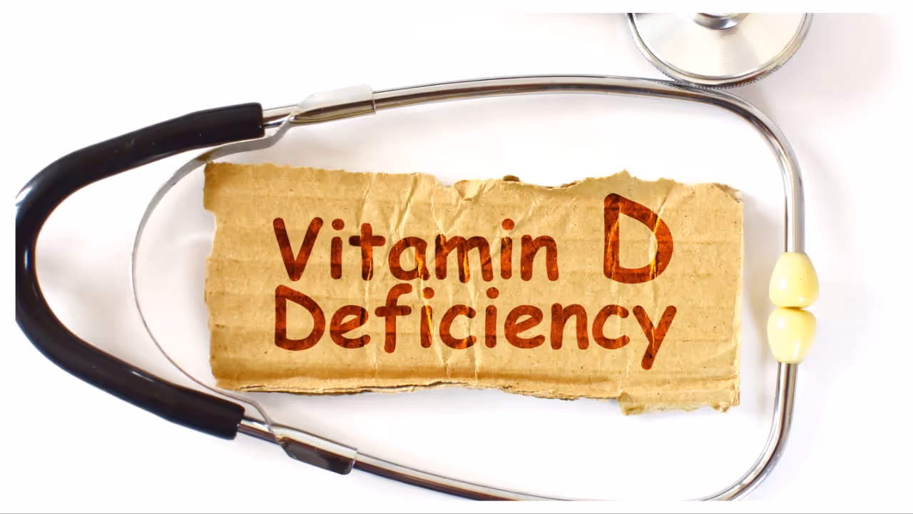 vitamin d deficiency vitamin d deficiency