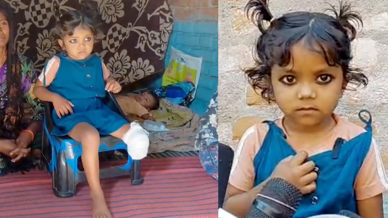 Banda Medical Negligence Case 5 Year Old Girl Loses Leg Raises Serious Questions on Healthcare System Banda Medical Negligence Case 5 Year Old Girl Loses Leg Raises Serious Questions on Healthcare System