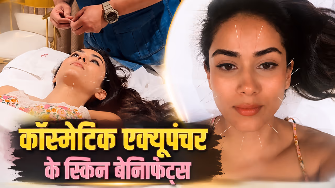 स्किन ट्रीटमेंट स्किन ट्रीटमेंट