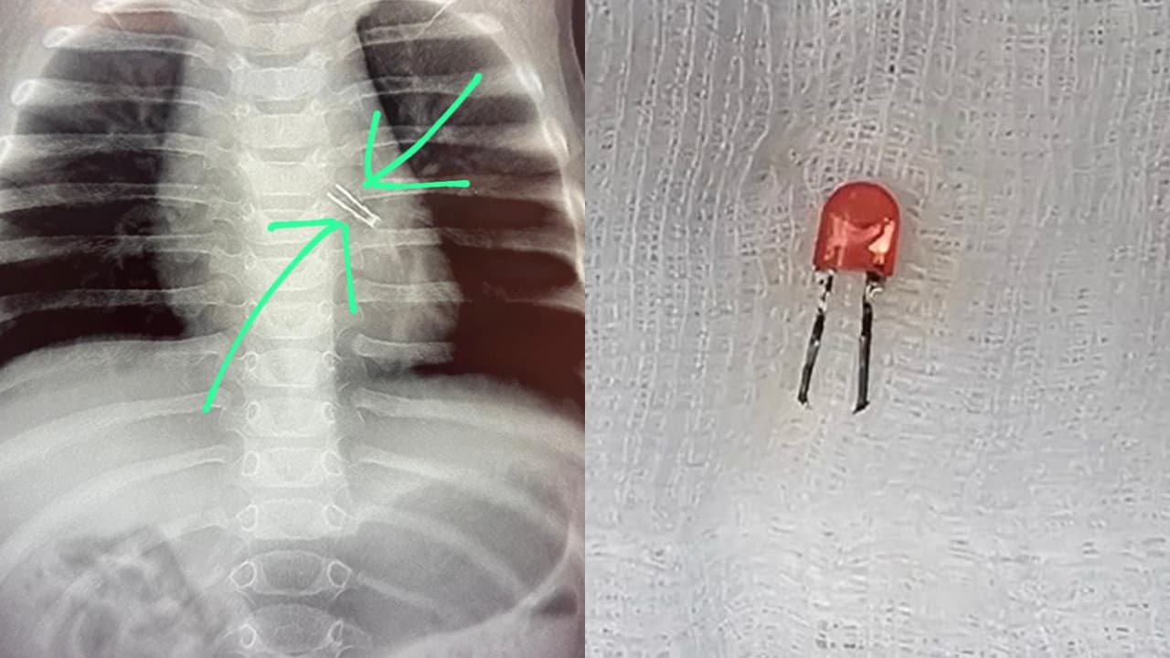 Viral Medical Story Viral Medical Story