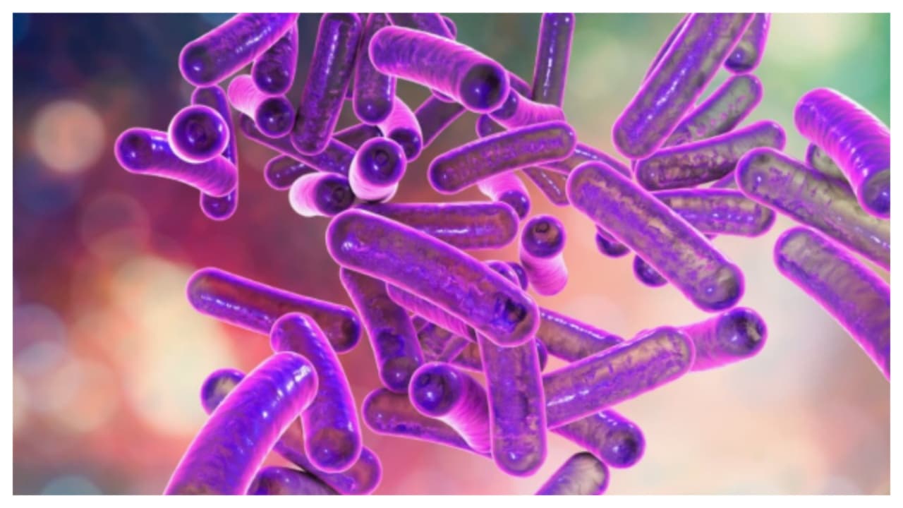shigella shigella