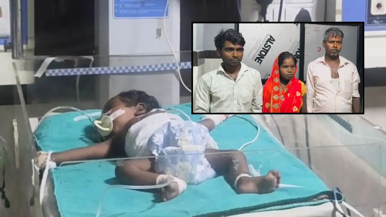 bareilly fetus in fetu 3 month baby stomach rare surgery medical miracle bareilly fetus in fetu 3 month baby stomach rare surgery medical miracle