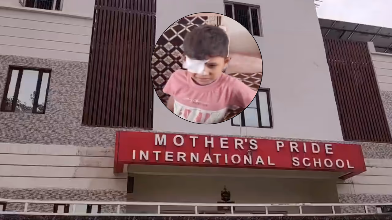 firozabad mother pride international school fir student eye injury firozabad mother pride international school fir student eye injury