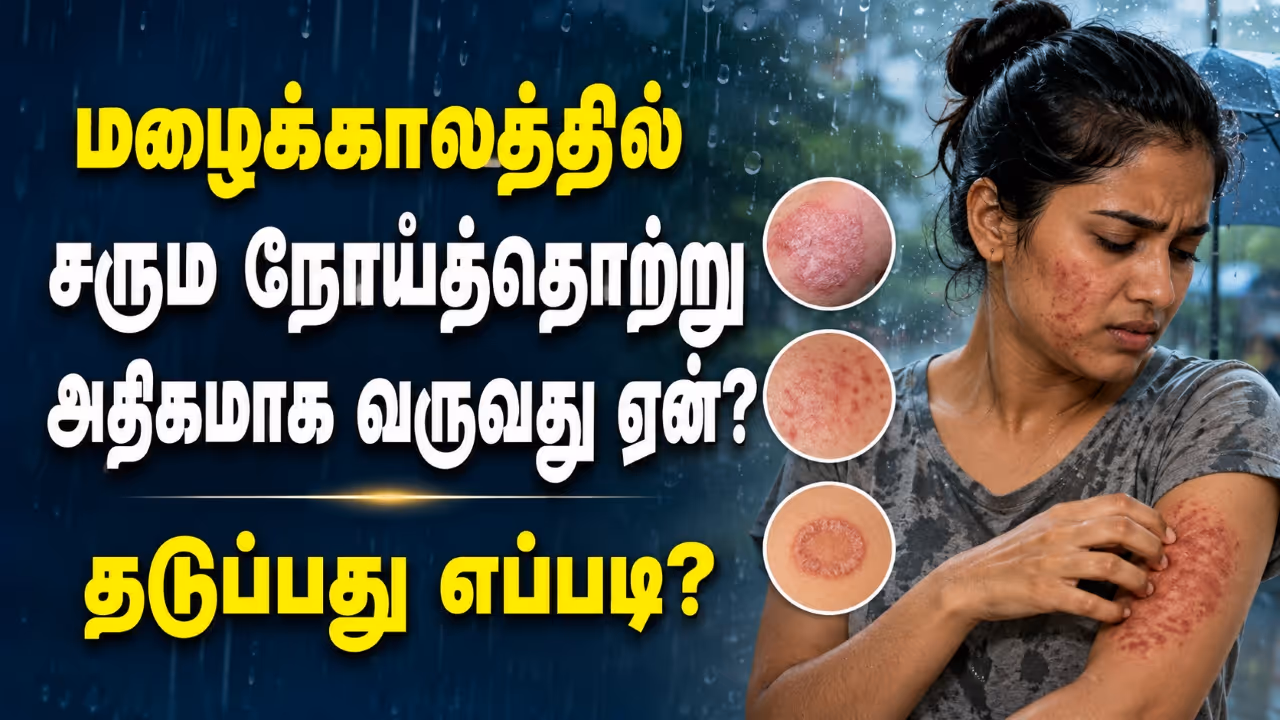 Monsoon Skin Care Why Fungal Infections Spike During The Rainy Season Monsoon Skin Care Why Fungal Infections Spike During The Rainy Season