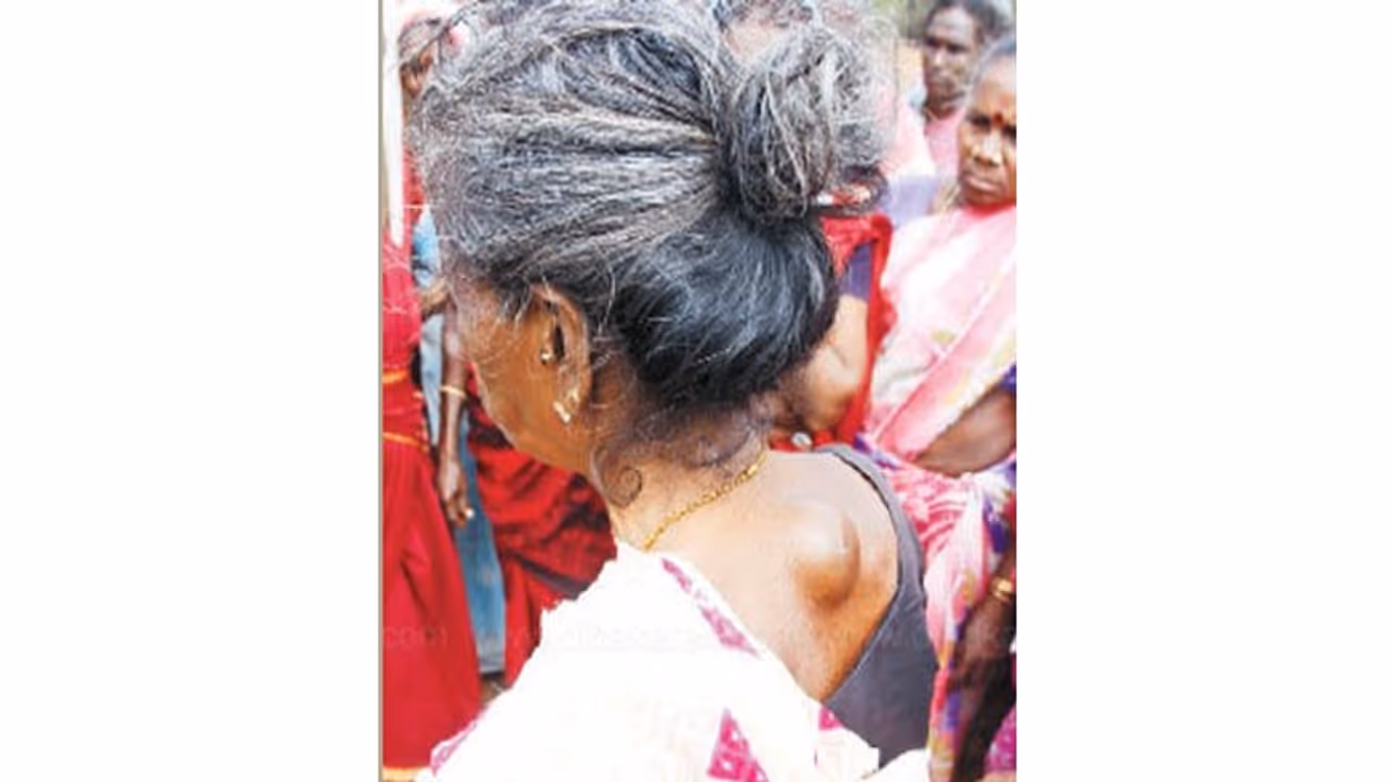 ஹைட்ரோ கார்பன் திட்டம் தீவிரம்... புற்று நோய் பாதிப்பில் நெடுவாசல் மக்கள் பரபரப்பு தகவல்கள் ஹைட்ரோ கார்பன் திட்டம் தீவிரம்... புற்று நோய் பாதிப்பில் நெடுவாசல் மக்கள் பரபரப்பு தகவல்கள்