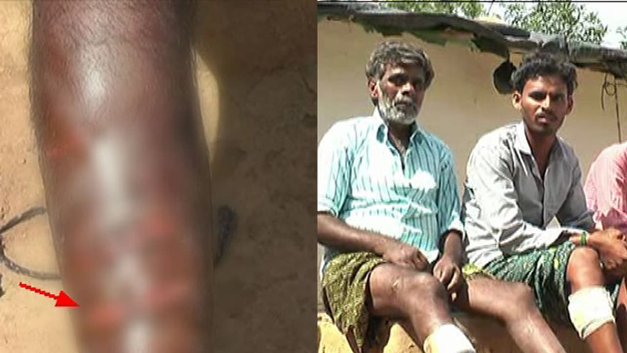 ಬಳ್ಳಾರಿಯಲ್ಲಿ ಮಂಗಗಳ ಹಾವಳಿ: 10ಕ್ಕೂ ಹೆಚ್ಚು ಮಂಗಗಳ ದಾಳಿಯಿಂದ ಗ್ರಾಮಸ್ಥರಿಗೆ ಗಂಭೀರ ಗಾಯ ಬಳ್ಳಾರಿಯಲ್ಲಿ ಮಂಗಗಳ ಹಾವಳಿ: 10ಕ್ಕೂ ಹೆಚ್ಚು ಮಂಗಗಳ ದಾಳಿಯಿಂದ ಗ್ರಾಮಸ್ಥರಿಗೆ ಗಂಭೀರ ಗಾಯ