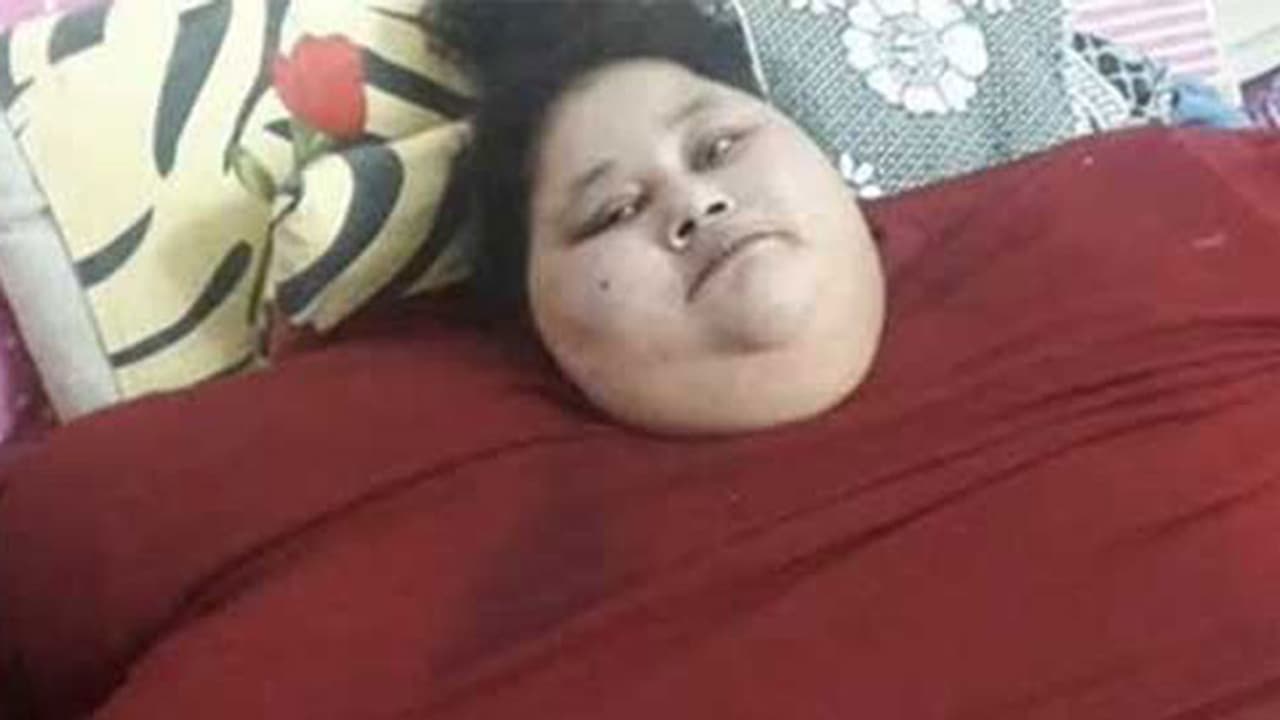 500 ಕೆ.ಜಿ ತೂಕದ ಈ ಮಹಿಳೆಗೆ ಮುಂಬೈನಲ್ಲಿ ತೂಕ ಇಳಿಸುವ ಶಸ್ತ್ರಚಿಕಿತ್ಸೆ 500 ಕೆ.ಜಿ ತೂಕದ ಈ ಮಹಿಳೆಗೆ ಮುಂಬೈನಲ್ಲಿ ತೂಕ ಇಳಿಸುವ ಶಸ್ತ್ರಚಿಕಿತ್ಸೆ