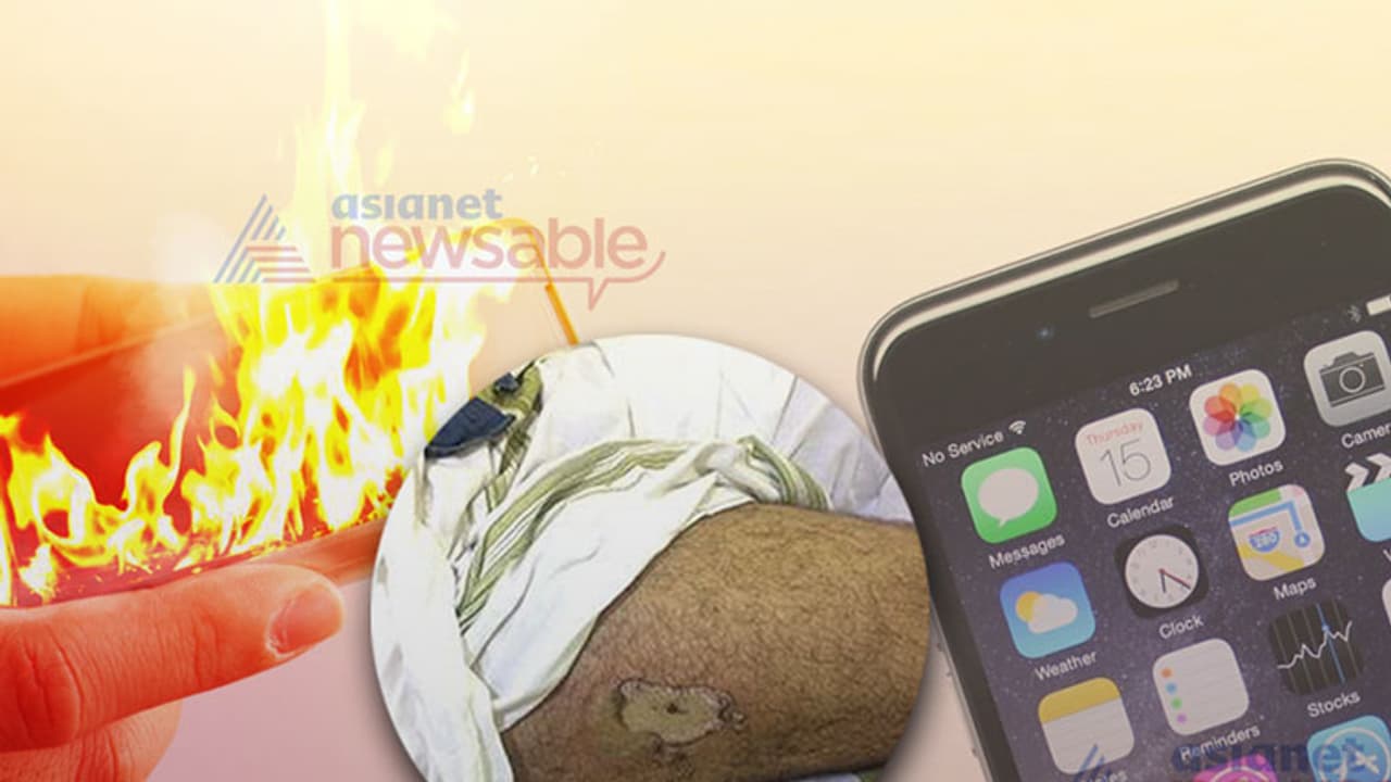 Brand new iPhone explodes in Kozhikode youth's pocket, causes severe burns Brand new iPhone explodes in Kozhikode youth's pocket, causes severe burns