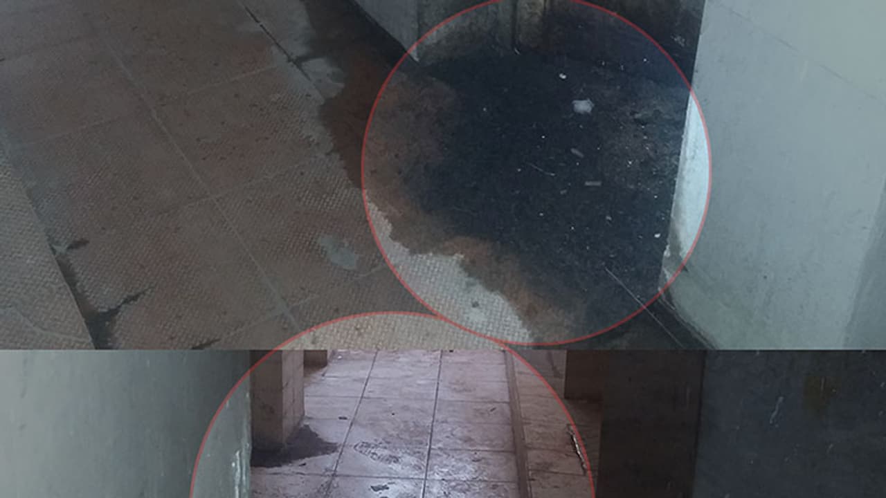 Bengaluru: This government hospital is worse than a public toilet Bengaluru: This government hospital is worse than a public toilet