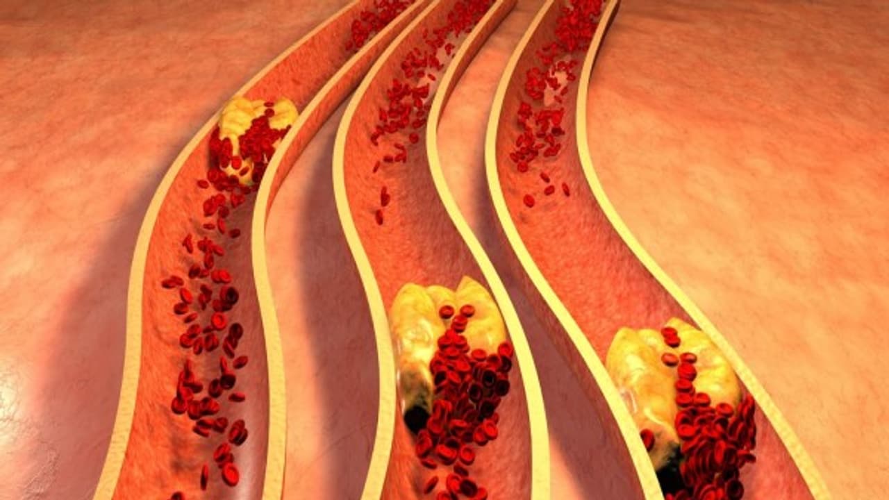 கொழுப்புகளை கரைத்து இரத்தக் குழாயை சுத்தமாக்க இதை சாப்பிட்டு பாருங்களேன்... கொழுப்புகளை கரைத்து இரத்தக் குழாயை சுத்தமாக்க இதை சாப்பிட்டு பாருங்களேன்...