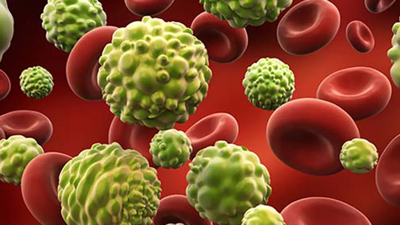 Two types of cancer that are hard to detect but can be treated