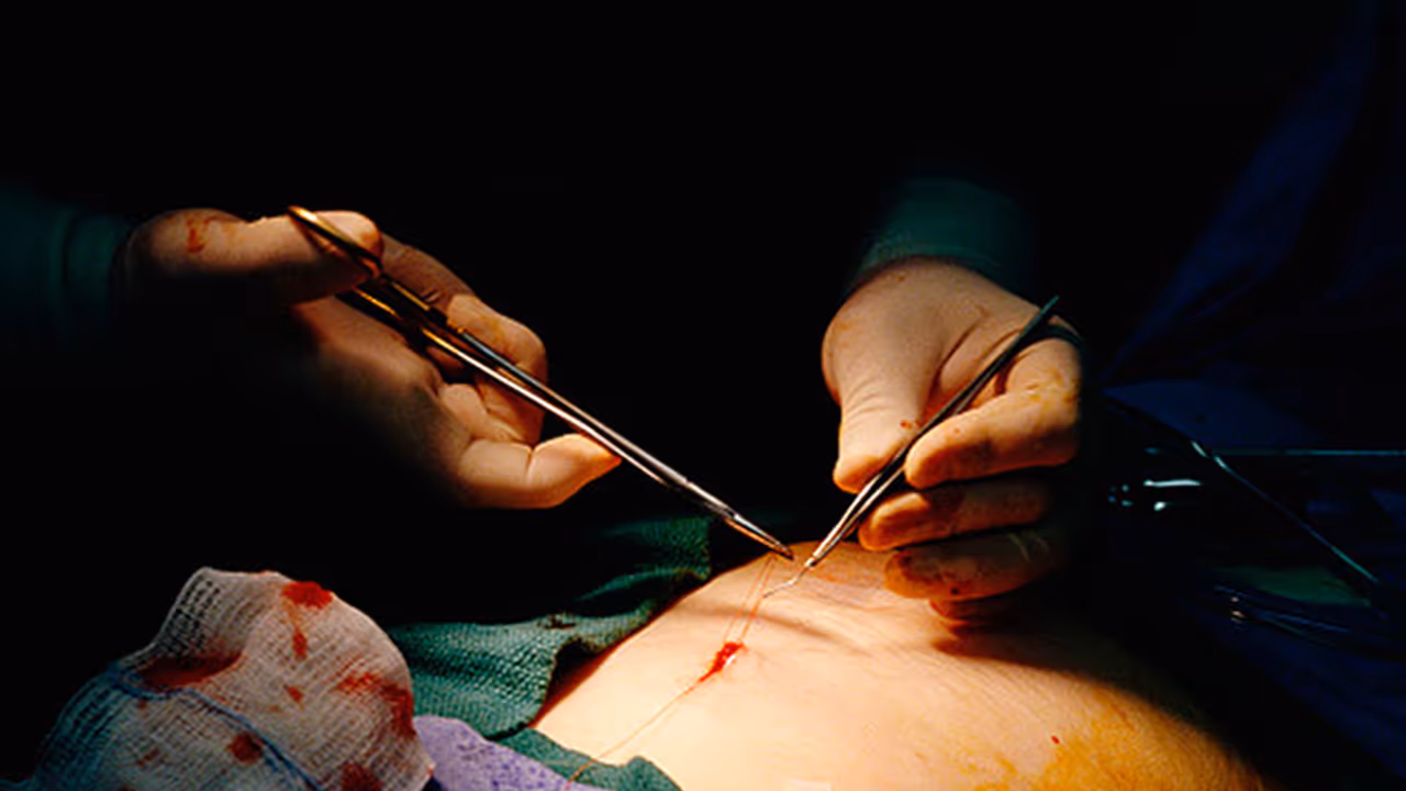 Thrissur youth goes to Sri Lanka for job, comes back without kidney Thrissur youth goes to Sri Lanka for job, comes back without kidney