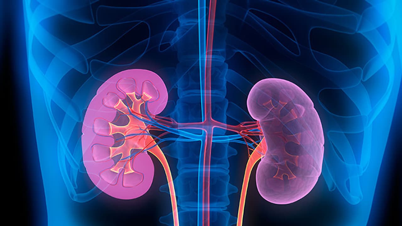 ಕಿಡ್ನಿ ಸ್ಟೋನ್ ಆಗುವುದಕ್ಕೆ ಏನು ಕಾರಣ? ಕಿಡ್ನಿ ಸ್ಟೋನ್ ಆಗುವುದಕ್ಕೆ ಏನು ಕಾರಣ?