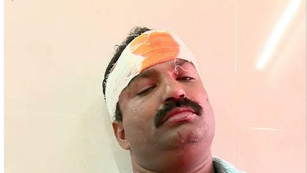 കൊല്ലത്ത് പാറഖനനത്തിനെതിരെ സമരം ചെയ്യുന്നവര്ക്ക് മര്ദ്ദനമേറ്റു കൊല്ലത്ത് പാറഖനനത്തിനെതിരെ സമരം ചെയ്യുന്നവര്ക്ക് മര്ദ്ദനമേറ്റു