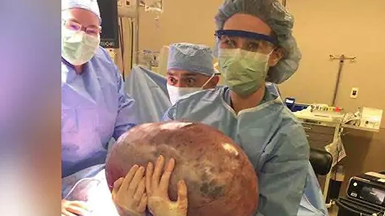 വയറുവേദനയുമായെത്തിയ യുവതിയുടെ വയറ്റിൽ നിന്ന് ഡോക്ടർമാർ കണ്ടെത്തിയത്... വയറുവേദനയുമായെത്തിയ യുവതിയുടെ വയറ്റിൽ നിന്ന് ഡോക്ടർമാർ കണ്ടെത്തിയത്...