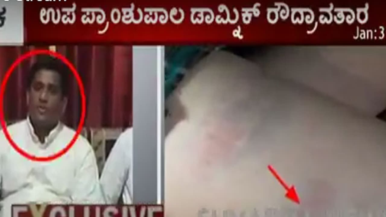 ಇಂಗ್ಲೀಷ್ ಬುಕ್ ತಂದಿಲ್ಲವೆಂದು ಬಾಲಕರಿಗೆ ಹಿಗ್ಗಾಮುಗ್ಗಾ ಥಳಿಸಿದ ಶಿಕ್ಷಕ ಇಂಗ್ಲೀಷ್ ಬುಕ್ ತಂದಿಲ್ಲವೆಂದು ಬಾಲಕರಿಗೆ ಹಿಗ್ಗಾಮುಗ್ಗಾ ಥಳಿಸಿದ ಶಿಕ್ಷಕ