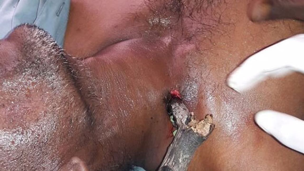 అమరావతి నీడలో నిజాలు... అటెండర్లే డాక్టర్లు (వీడియో) అమరావతి నీడలో నిజాలు... అటెండర్లే డాక్టర్లు (వీడియో)