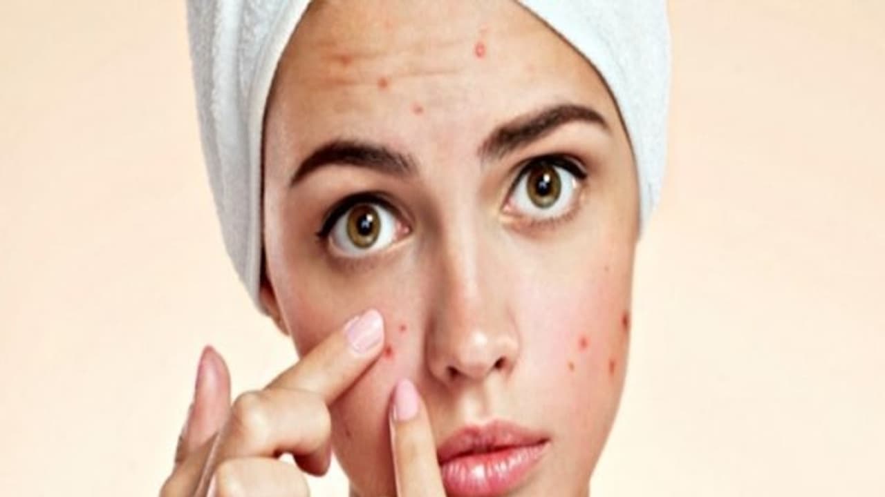 எண்ணெய் சருமத்தில் முகப்பருக்கள் வந்தால் பயப்பட வேண்டாம்? சூப்பர் டிப்ஸ் உள்ளே... எண்ணெய் சருமத்தில் முகப்பருக்கள் வந்தால் பயப்பட வேண்டாம்? சூப்பர் டிப்ஸ் உள்ளே...