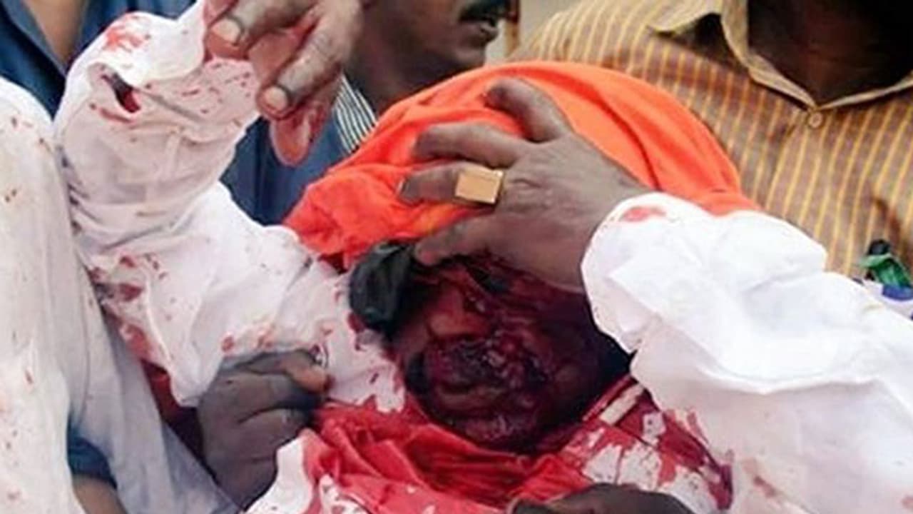 ലോ അക്കാദമി സമരത്തിന് നേരെ പൊലീസിന്റെ ഗ്രനേഡ് പ്രയോഗം; ബി.ജെ.പി നേതാവിന്റെ കാഴ്ച നഷ്ടമായി ലോ അക്കാദമി സമരത്തിന് നേരെ പൊലീസിന്റെ ഗ്രനേഡ് പ്രയോഗം; ബി.ജെ.പി നേതാവിന്റെ കാഴ്ച നഷ്ടമായി