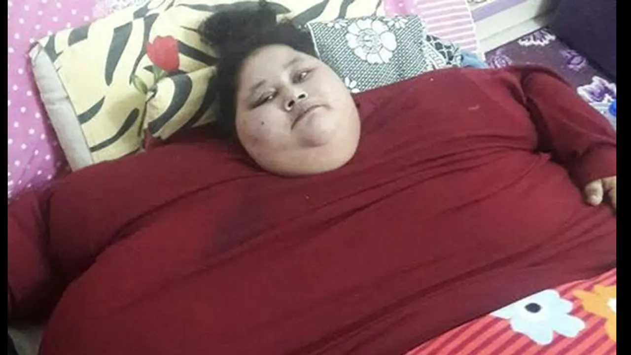 ಜಗತ್ತಿನ ಅತೀ ತೂಕದ ಮಹಿಳೆ ಎಮನ್ ಅಹ್ಮದ್ ಅಬುದಾಬಿಗೆ ವಾಪಸ್ ಜಗತ್ತಿನ ಅತೀ ತೂಕದ ಮಹಿಳೆ ಎಮನ್ ಅಹ್ಮದ್ ಅಬುದಾಬಿಗೆ ವಾಪಸ್