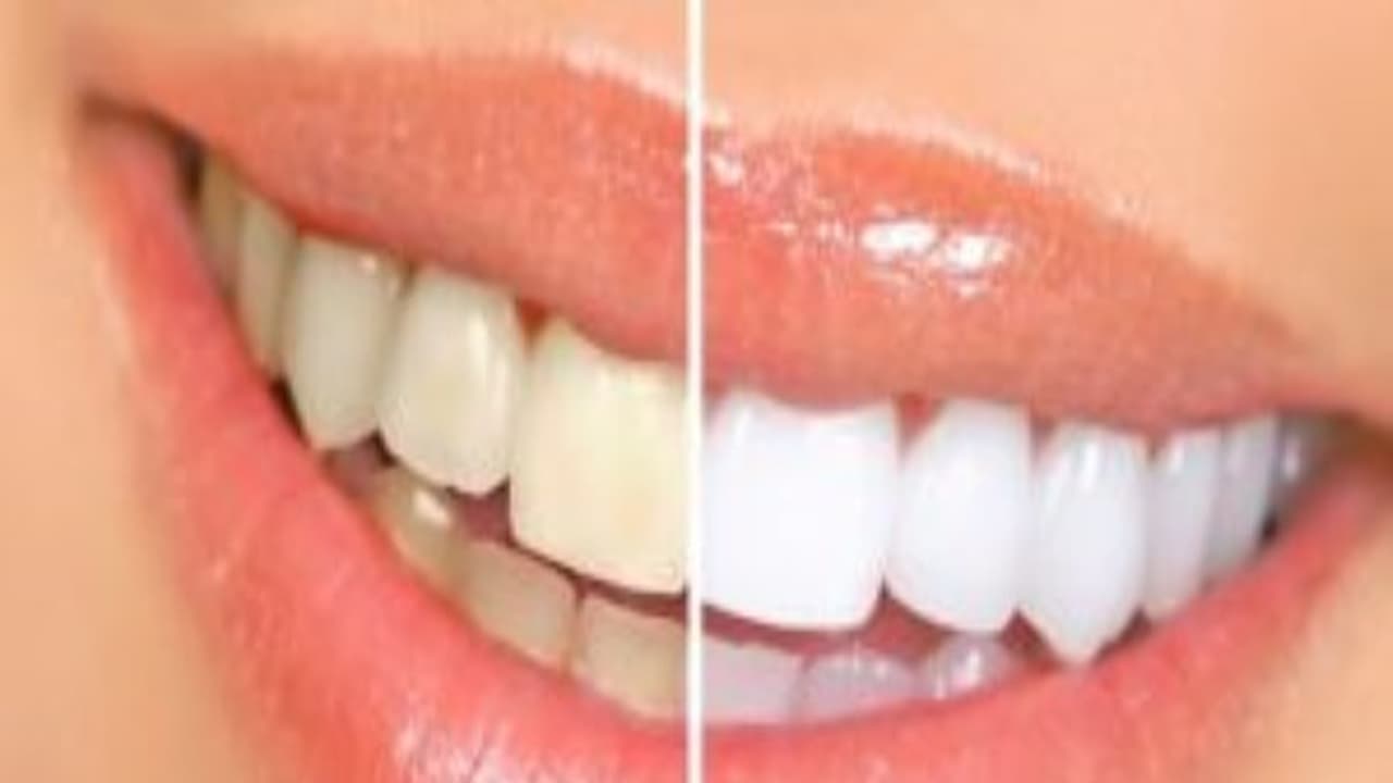 மஞ்சள் கறைகளைப் போக்கி, பற்களை வலுவாக்க வீட்டிலேயே தயாரிக்கலாம் நேச்சுரல் டூத் பேஸ்ட்… மஞ்சள் கறைகளைப் போக்கி, பற்களை வலுவாக்க வீட்டிலேயே தயாரிக்கலாம் நேச்சுரல் டூத் பேஸ்ட்…