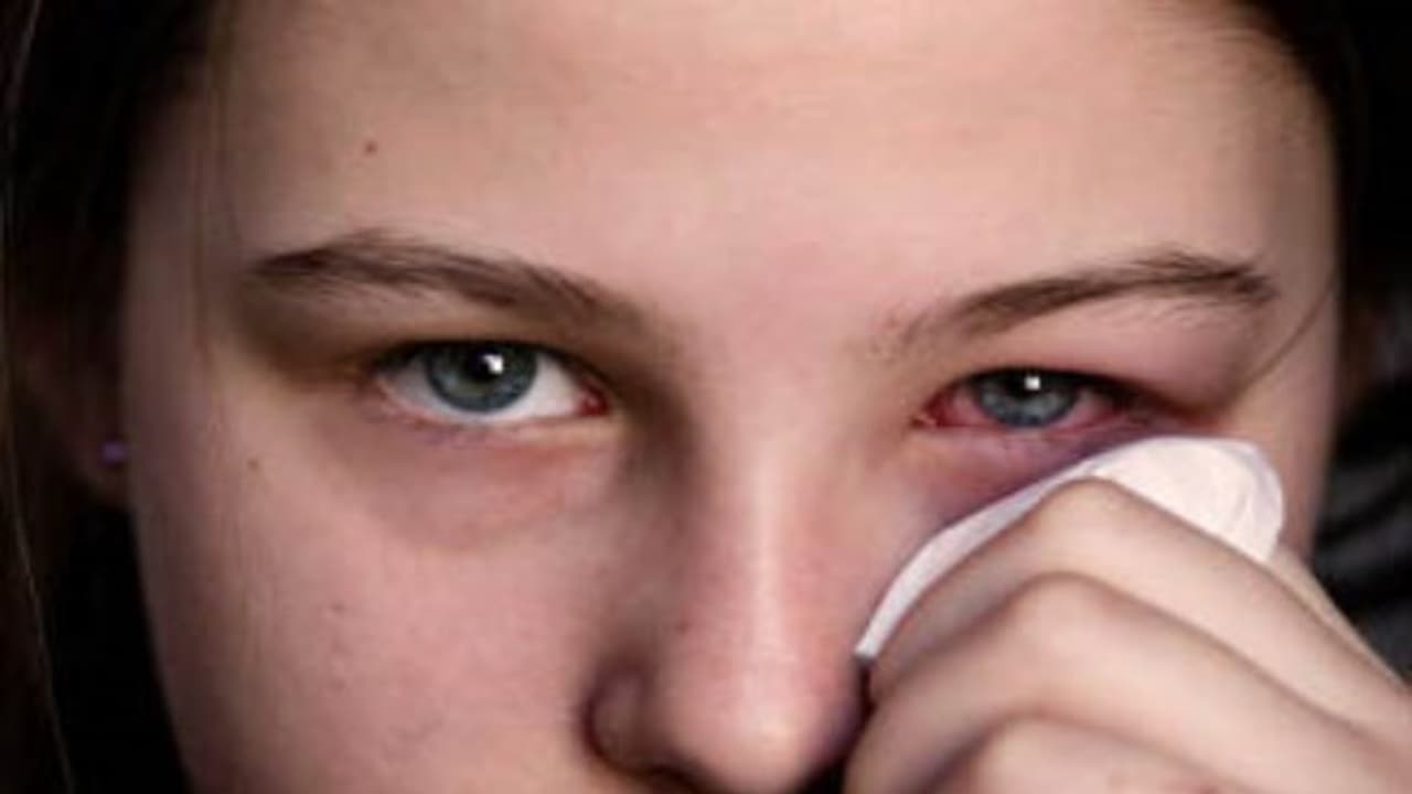 கண்களில் இதுபோன்ற பிரச்சனைகள் இருந்தால் உடலுறுப்பு பெரும் ஆபத்தில் இருக்குனு அர்த்தம்... கண்களில் இதுபோன்ற பிரச்சனைகள் இருந்தால் உடலுறுப்பு பெரும் ஆபத்தில் இருக்குனு அர்த்தம்...