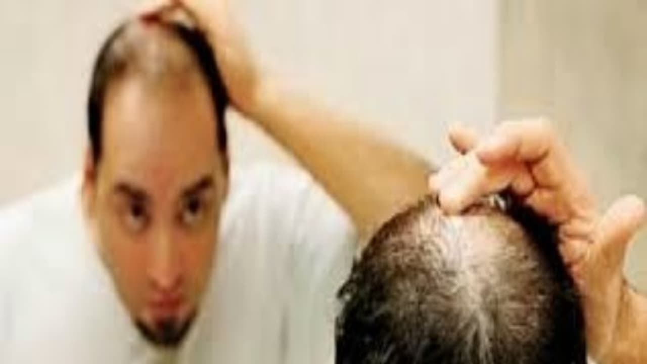 உங்களுக்குத் தெரியுமா? இந்த யுக்தியை பயன்படுத்தினால் வழுக்கைத் தலையிலும் முடி வளரும். உங்களுக்குத் தெரியுமா? இந்த யுக்தியை பயன்படுத்தினால் வழுக்கைத் தலையிலும் முடி வளரும்.