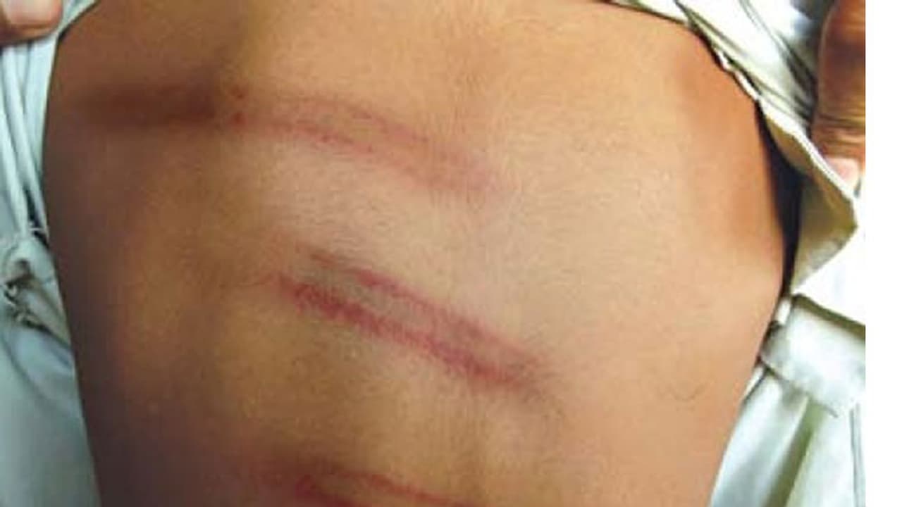 దేశానికి వాతలు పడ్డాయి దేశానికి వాతలు పడ్డాయి