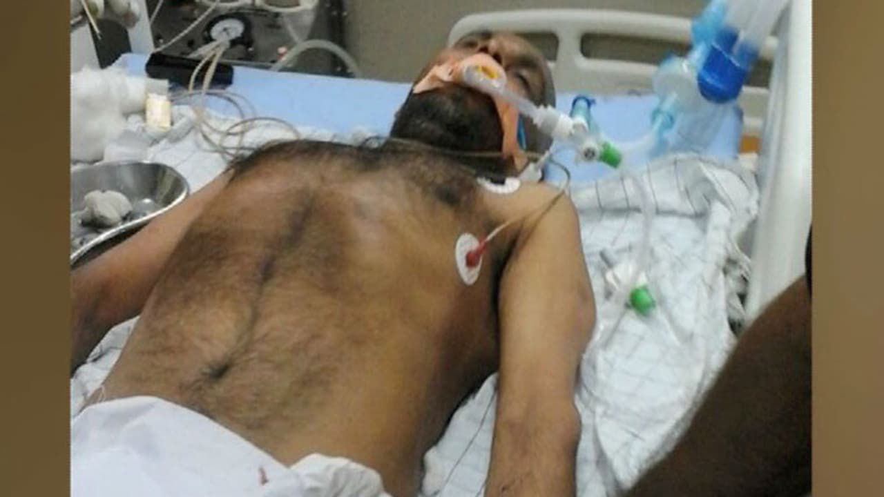 പൂഞ്ഞാര് തോല്വി: പരാതി നല്കിയ സി.പി.എം നേതാവ് ഗുരുതര പരിക്കേറ്റ് അബോധാവസ്ഥയില്; നേതാക്കള് അക്രമിച്ചെന്ന് മകന് പൂഞ്ഞാര് തോല്വി: പരാതി നല്കിയ സി.പി.എം നേതാവ് ഗുരുതര പരിക്കേറ്റ് അബോധാവസ്ഥയില്; നേതാക്കള് അക്രമിച്ചെന്ന് മകന്