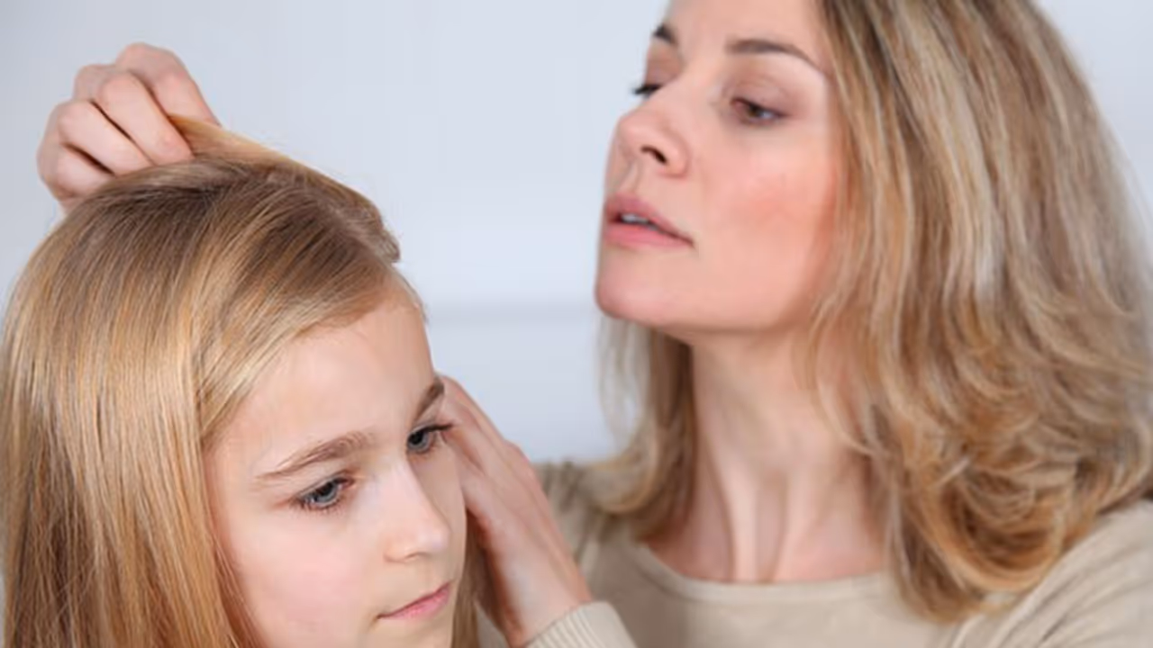 പേൻ ശല്യം മാറ്റാൻ 7 വഴികൾ പേൻ ശല്യം മാറ്റാൻ 7 വഴികൾ