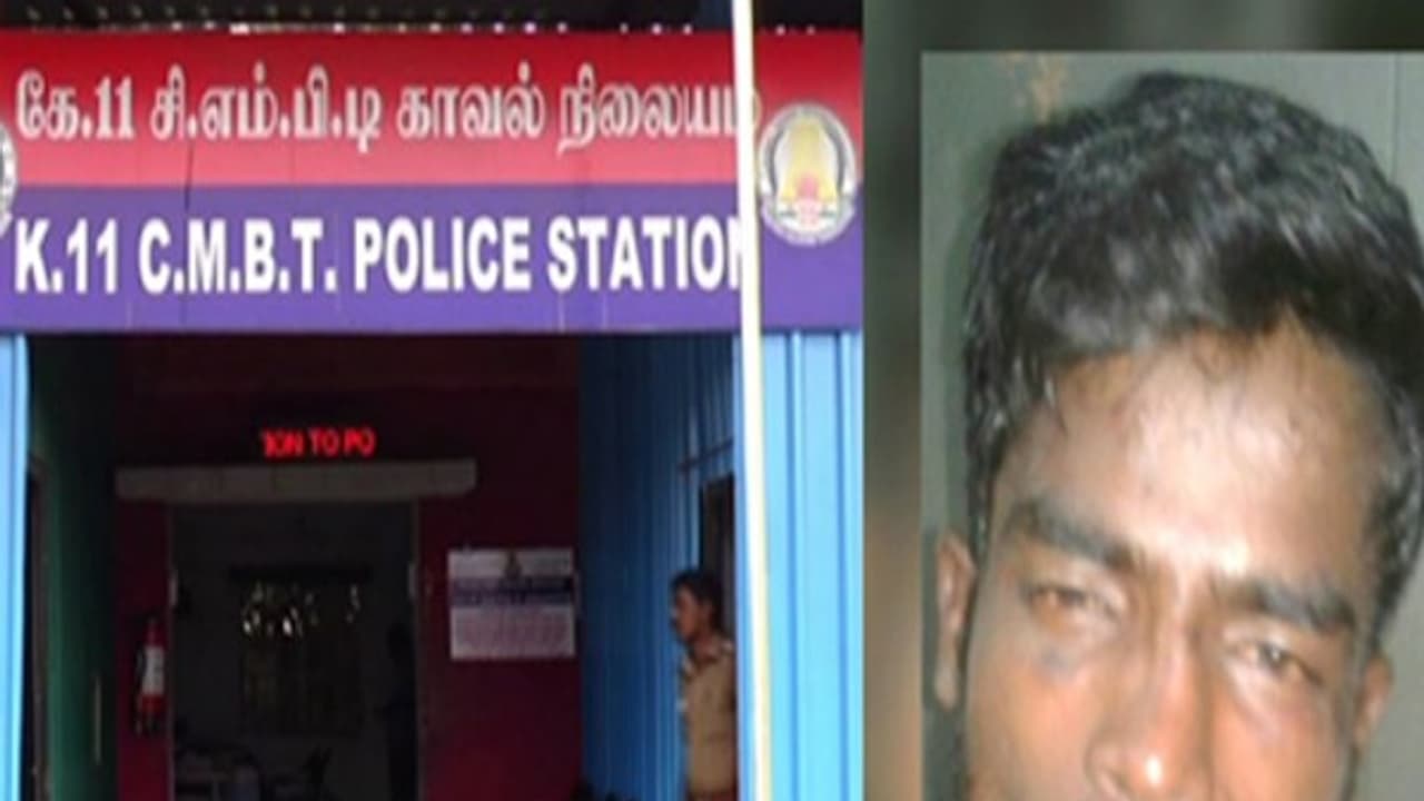 போலீசாரின் கைவிரலைத் கடித்து துப்பிய கொள்ளையன்...! ரத்தம் சொட்ட சொட்ட துரத்திப் பிடித்த போலீஸ்...! போலீசாரின் கைவிரலைத் கடித்து துப்பிய கொள்ளையன்...! ரத்தம் சொட்ட சொட்ட துரத்திப் பிடித்த போலீஸ்...!