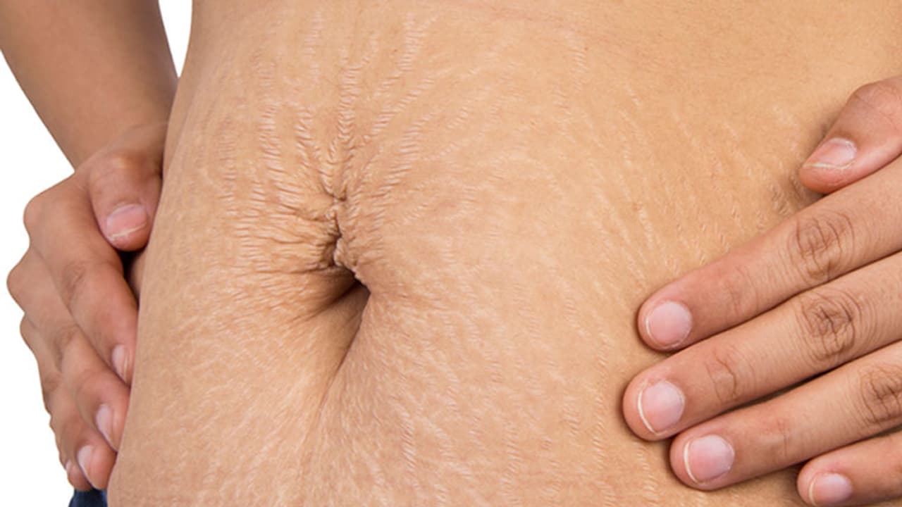 ശരീരത്തിലെ പാടുകള് മാറ്റാന് അഞ്ച് വഴികള് ശരീരത്തിലെ പാടുകള് മാറ്റാന് അഞ്ച് വഴികള്