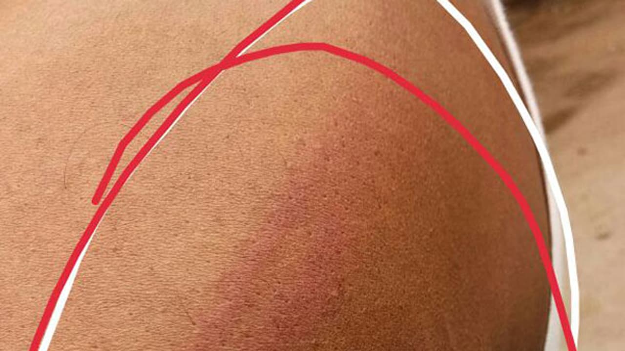 హైదరాబాద్ జర్నలిస్టుపై పోలీసుల దాడి హైదరాబాద్ జర్నలిస్టుపై పోలీసుల దాడి