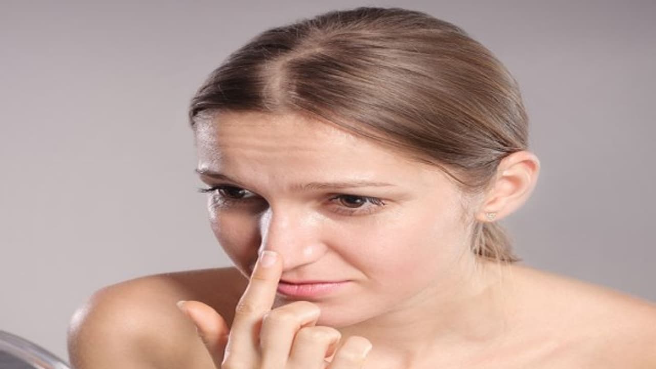 ஆண்,பெண் இருவருக்கும் முகத்தில் கரும்புள்ளிகள் வருவதற்கு இதெல்லாம்தான் காரணம்... ஆண்,பெண் இருவருக்கும் முகத்தில் கரும்புள்ளிகள் வருவதற்கு இதெல்லாம்தான் காரணம்...