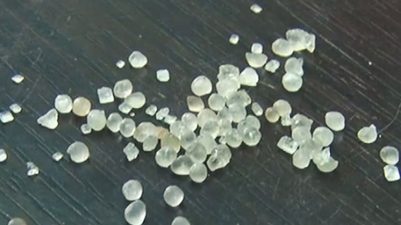 After Gadag plastic sugar reported in Hassan sample sent to Mysore lab for test After Gadag plastic sugar reported in Hassan sample sent to Mysore lab for test