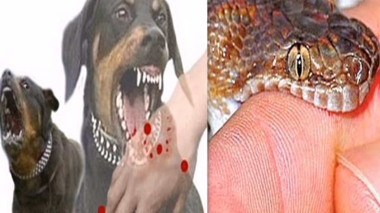 வெறி நாய் கடி... பாம்பு கடி... எந்த கடிக்கு என்ன மருந்து கொடுக்கணும் தெரியுமா? இதை செய்தால் போதும்... வெறி நாய் கடி... பாம்பு கடி... எந்த கடிக்கு என்ன மருந்து கொடுக்கணும் தெரியுமா? இதை செய்தால் போதும்...