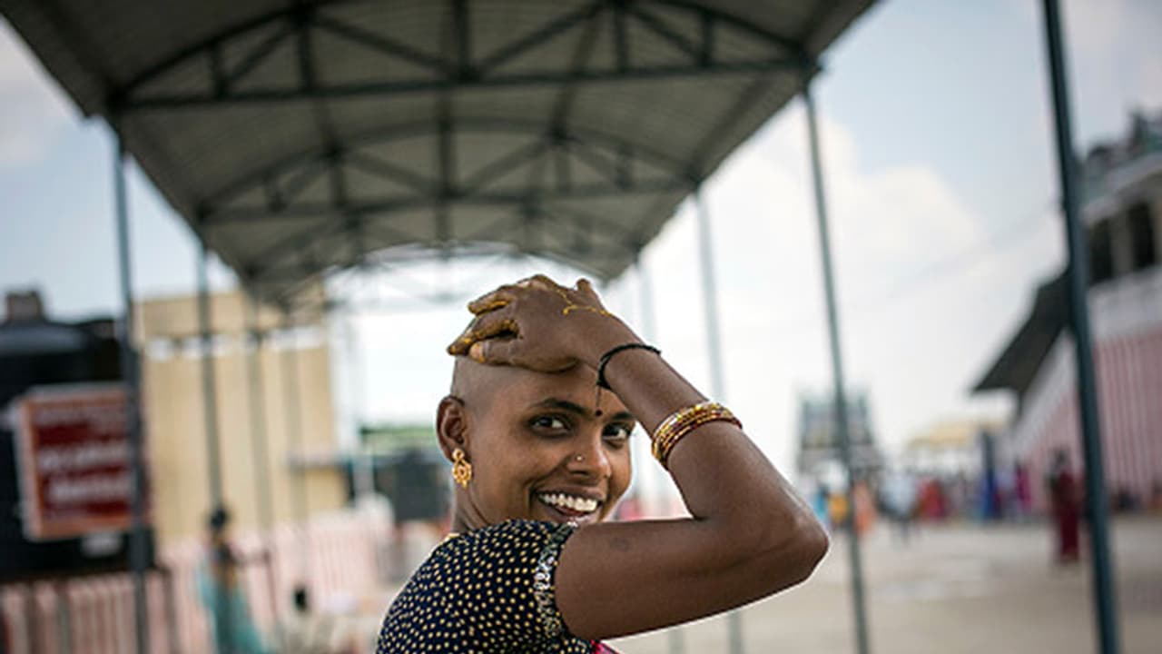 Chennai: Bald is beautiful, is this NGO's message to women Chennai: Bald is beautiful, is this NGO's message to women