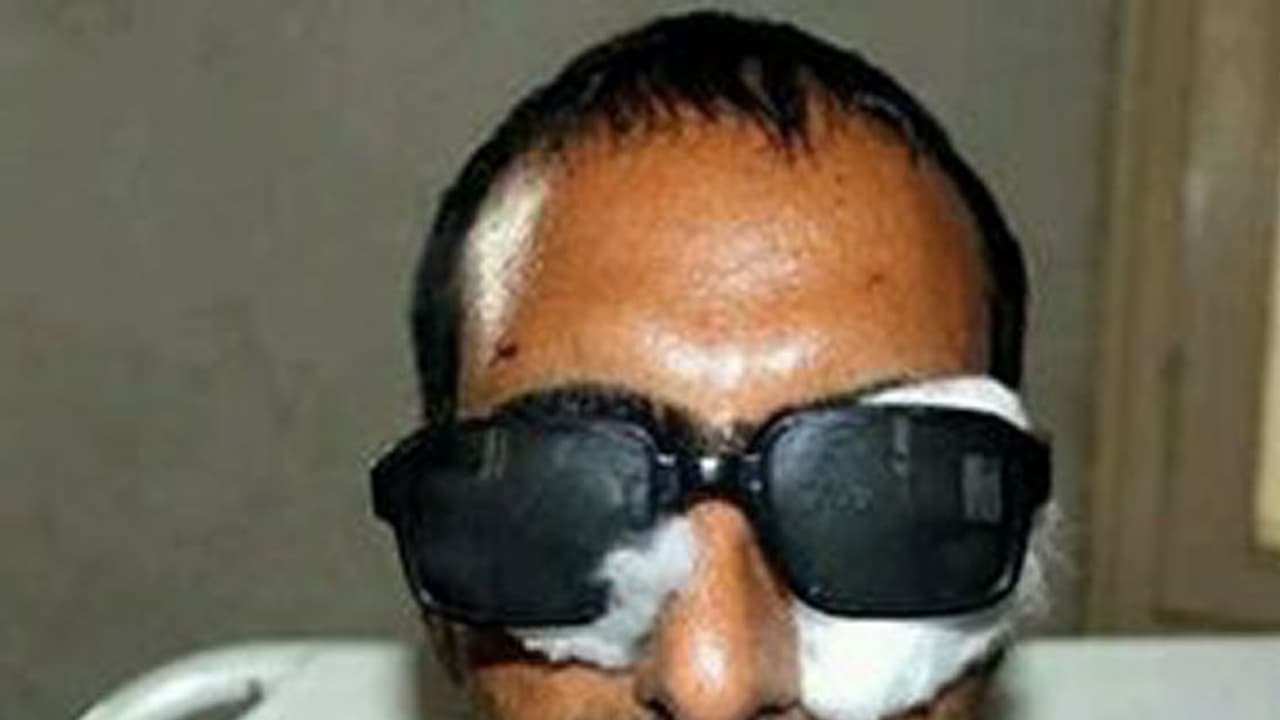 പെല്ലറ്റ് ആക്രമണത്തില് കാഴ്ച നഷ്ടപ്പെട്ടു; ചികിത്സയ്ക്കായി ന്യൂസ് ഏജന്സി മാധ്യമപ്രവര്ത്തകന് വിറ്റു പെല്ലറ്റ് ആക്രമണത്തില് കാഴ്ച നഷ്ടപ്പെട്ടു; ചികിത്സയ്ക്കായി ന്യൂസ് ഏജന്സി മാധ്യമപ്രവര്ത്തകന് വിറ്റു