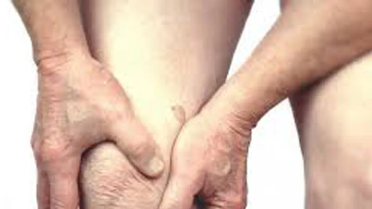 Arthritis: ভুলেও খাবেন না এই কয়টি খাবার, বাড়তে পারে আর্থ্রারাইটিস Arthritis: ভুলেও খাবেন না এই কয়টি খাবার, বাড়তে পারে আর্থ্রারাইটিস