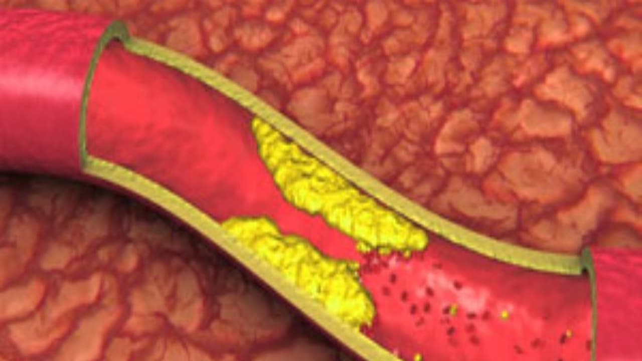 ரத்தகுழாய் அடைப்பை நீக்கும் இயற்கை பானம்; செய்முறையும் உள்ளே இருக்கு... ரத்தகுழாய் அடைப்பை நீக்கும் இயற்கை பானம்; செய்முறையும் உள்ளே இருக்கு...