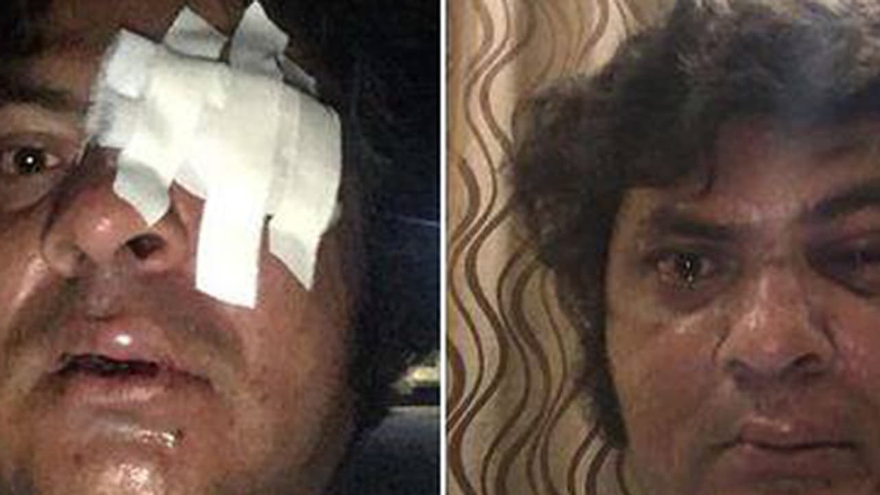 ಮಾಜಿ ಸಚಿವರ ಪುತ್ರನ ಮೇಲೆ ಮಾರಣಾಂತಿಕ ಹಲ್ಲೆ ಮಾಜಿ ಸಚಿವರ ಪುತ್ರನ ಮೇಲೆ ಮಾರಣಾಂತಿಕ ಹಲ್ಲೆ