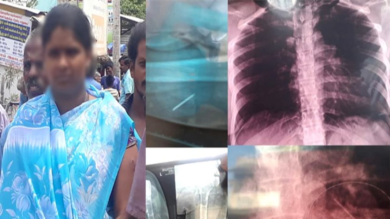 நோயாளியின் உடலுக்குள் புகுந்த ஊசி... கர்ப்ப ஸ்த்ரீக்கு ஏற்பட்ட கொடுமை! அரசு மருத்துவமனையின் அலட்சியம்! நோயாளியின் உடலுக்குள் புகுந்த ஊசி... கர்ப்ப ஸ்த்ரீக்கு ஏற்பட்ட கொடுமை! அரசு மருத்துவமனையின் அலட்சியம்!