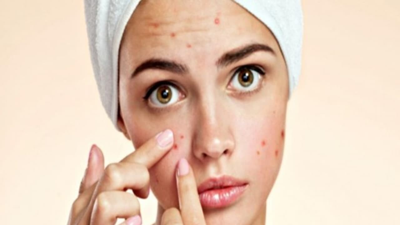 தோலில் ஏற்படும் அனைத்து பிரச்சனைகளை போக்க இந்த மூன்று மூலிகையே போதும்... எளிதில் கிடைக்கும்ங்க.... தோலில் ஏற்படும் அனைத்து பிரச்சனைகளை போக்க இந்த மூன்று மூலிகையே போதும்... எளிதில் கிடைக்கும்ங்க....