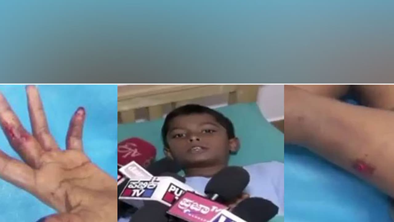 11 year old Karnataka boy fights off Python attack 11 year old Karnataka boy fights off Python attack