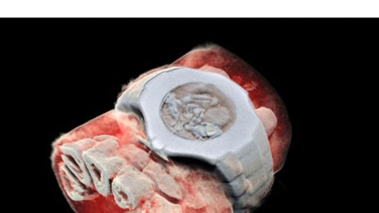 ബ്ലാക്ക് ആന്ഡ് വൈറ്റില് അല്ല; ഇനി എക്സ്റെ കളറില് കാണാം ബ്ലാക്ക് ആന്ഡ് വൈറ്റില് അല്ല; ഇനി എക്സ്റെ കളറില് കാണാം