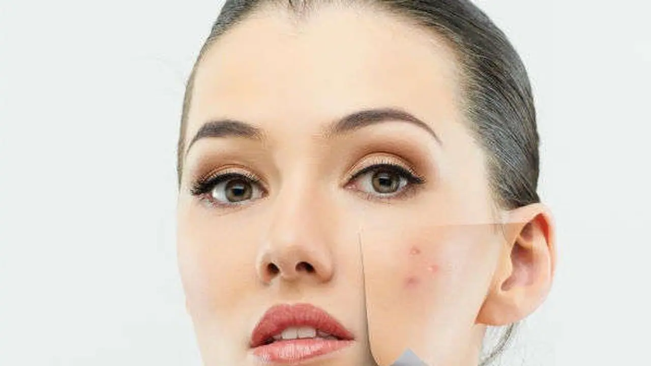 பளிச்சென்ற முகம் பெற வேண்டுமா? இதோ பக்கவிளைவு இல்லாத இயற்கை வைத்திய முறை...